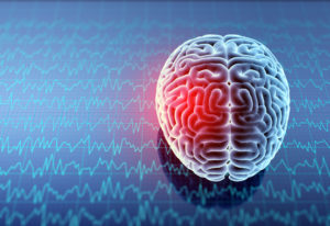 What Causes Traumatic Brain Injuries?