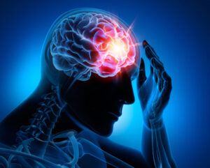 How Roman Austin Personal Injury Lawyers Can Help If You Suffer a Brain Injury in Dunedin, FL