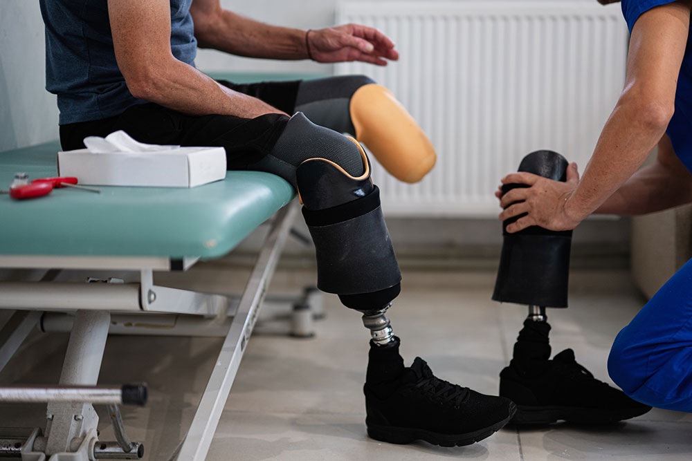 Prosthetic leg fitting and adjustment during rehabilitation treatment in a clinic